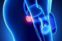 exercise and prostate cancer
