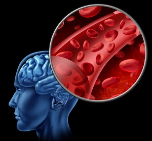 folic acid for stroke prevention